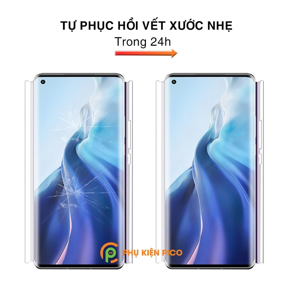 Dán màn hình Xiaomi Mi 11 360 Độ, bo cong trước sau - Dán PPF Mi 11 360 Độ - 13